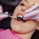 Respingere implanturi dentare